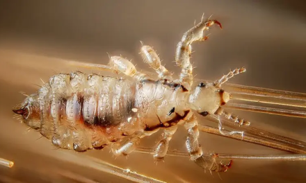 Parasit Kecil Kutu Membuat Rasa Tidak Nyaman Terutama Rambut