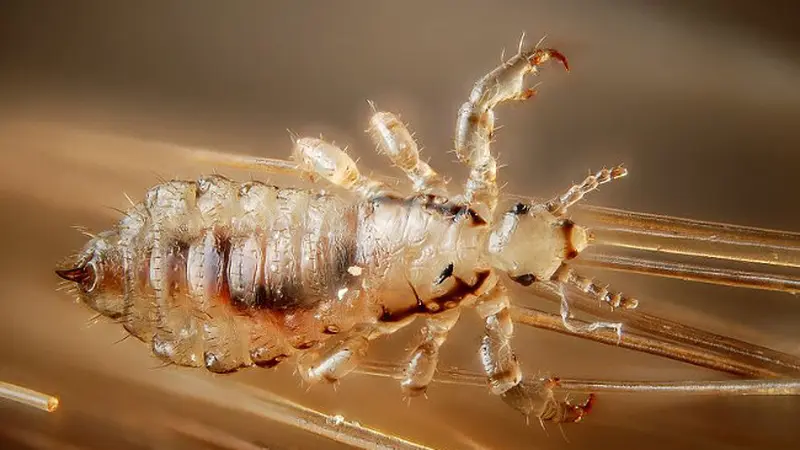 Parasit Kecil Kutu Membuat Rasa Tidak Nyaman Terutama Rambut
