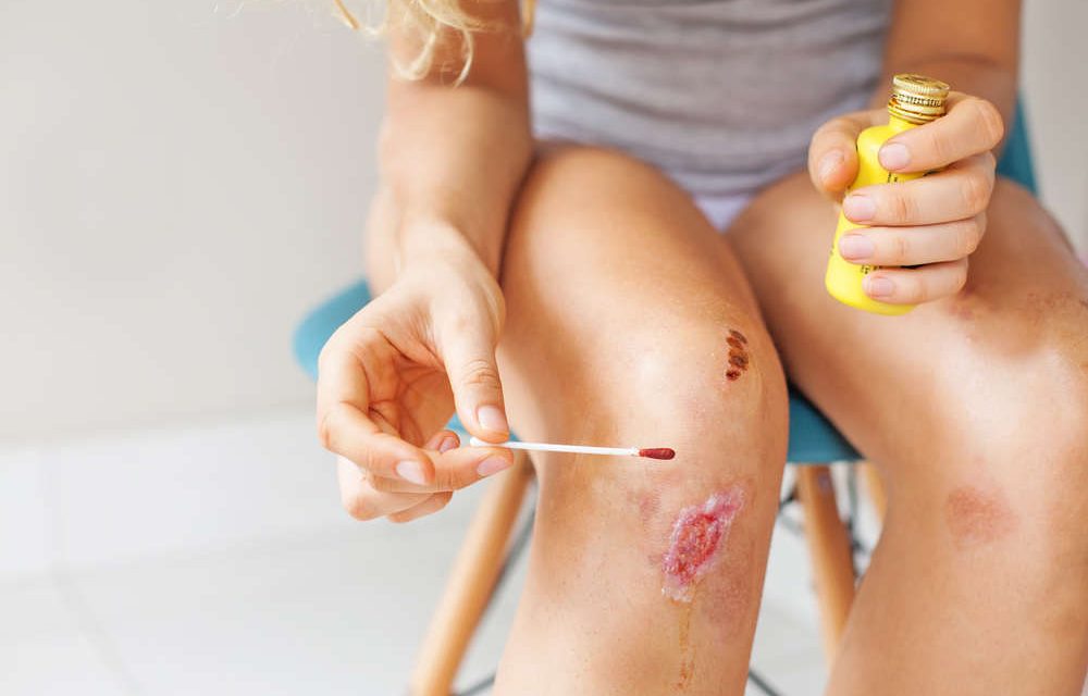 Pengobatan Luka Dengan Betadine Bahan Antiseptik