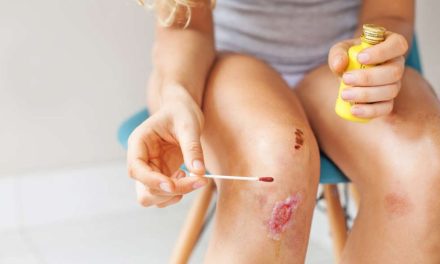 Pengobatan Luka Dengan Betadine Bahan Antiseptik