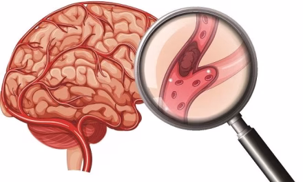 Keadaan Sakit Stroke Yang Sulit Untuk Bergerak